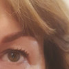 фото от пользователя Елена в отзыве о центре медицинской косметологии Beauty Сlub на Школьной улице