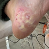 фото от пользователя Ирина  в отзыве о центре подологии Podo_clinik_msk