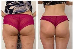 Массажный салон EFFECT8, с рейтингом 2 - находится по адресу Алматы, Бостандыкский район, улица Берёзовая Аллея, 8 