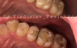 фотография работы врача Владислава Руслановича Павленко