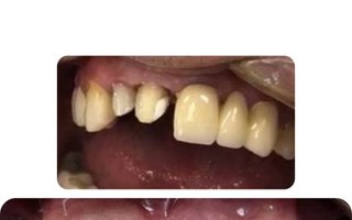 фотография работы врача Артака Меружановича Аветисяна