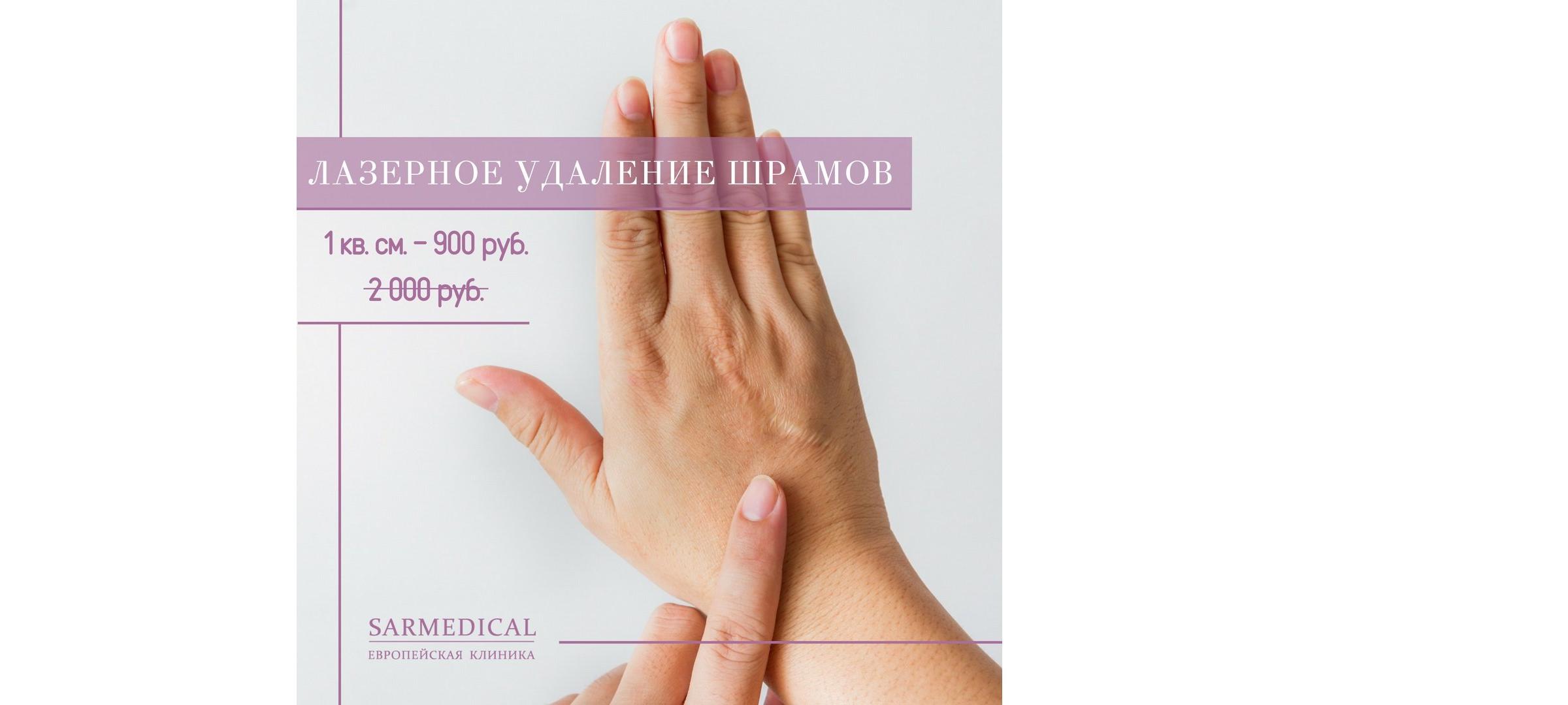 Sarmedical купоны на эпиляцию