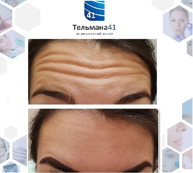 фотография работы Медицинского центра Тельмана 41 (Центр имплантологии доктора Зорина)