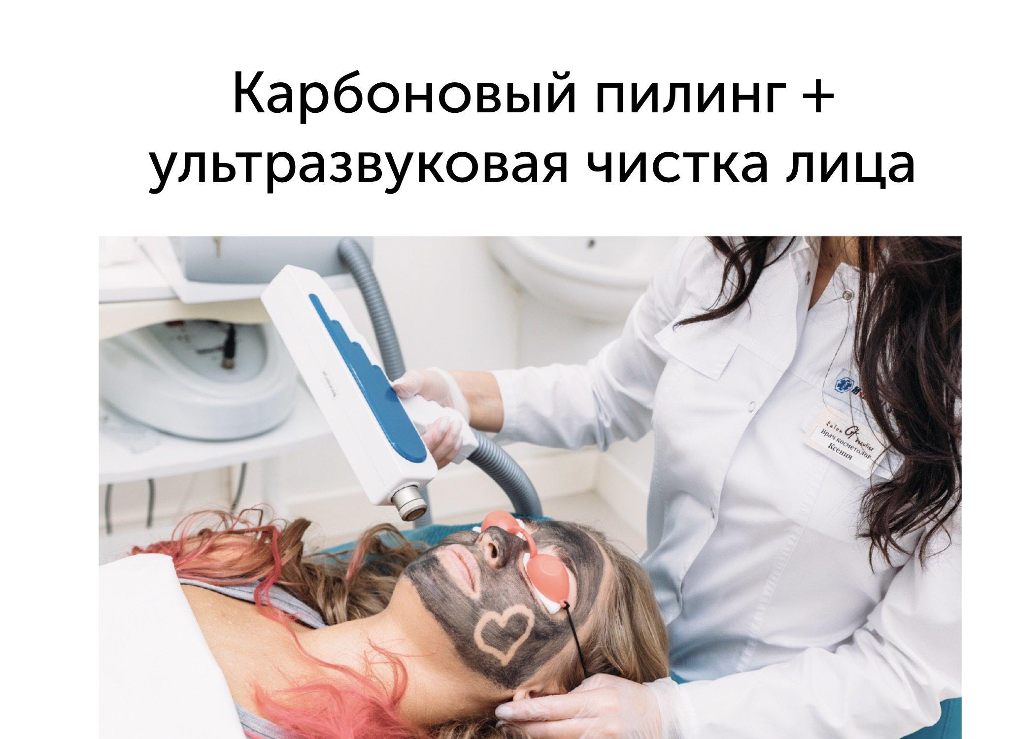 Что Такое Карбоновый Пилинг Лица Фото