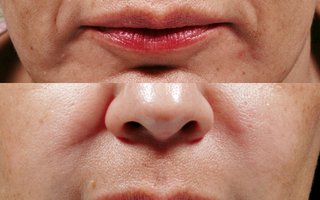 фотография работы врача Анжелики Викторовны Хешы