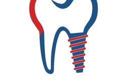 Клиника современной стоматологии Доктора Макарова, с рейтингом 4.9 - находится по адресу Башкортостан, Уфа, Ленинский район, Затон, 450017, улица Ахметова, 225 
