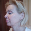 фото от пользователя Ирина в отзыве о клинике эстетической медицины DEGA в Невском районе