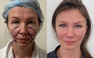 фотография работы врача Дмитрия Олеговича Васильева