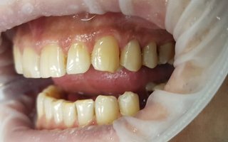фотография работы врача Лауры Григорьевны Мнацаканян