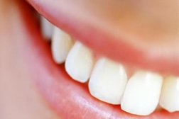 Стоматология Дентасервислюкс, с рейтингом 3.4 - находится по адресу Алматы, Кажымукана, 34 