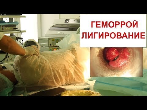 Ректороманоскопия | Самарский Диагностический Центр