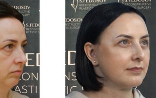 фотография работы специалиста по красоте Семена Игоревича Федосова