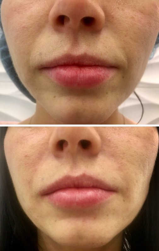 фотография работы Центра медицинской косметологии Beauty Сlub на Школьной улице