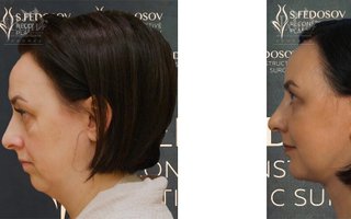 фотография работы специалиста по красоте Семена Игоревича Федосова