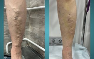 фотография работы врача Илья Николаевича Сороквашы