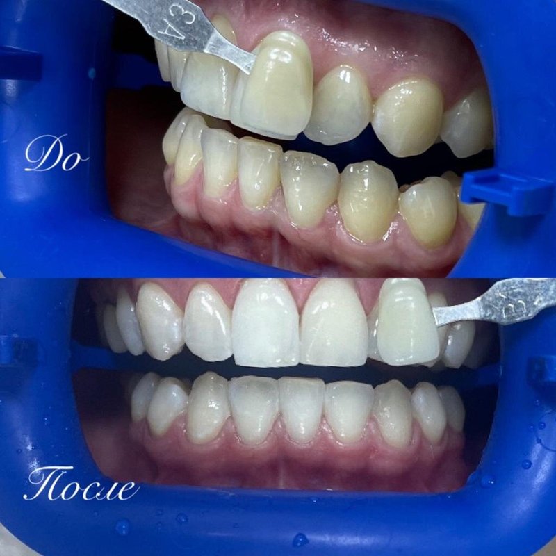 фотография работы Стоматологической клиники New Smile