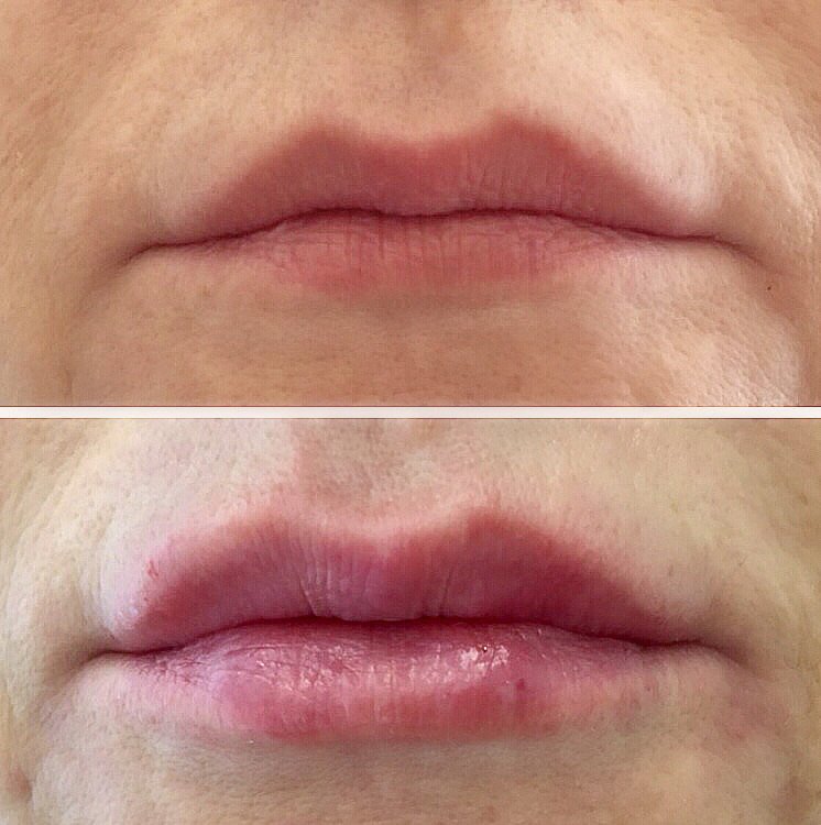 фотография работы Центра медицинской косметологии Beauty Сlub на Школьной улице