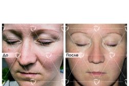 Клиника лазерной косметологии Линлайн, с рейтингом 4 - находится по адресу Ханты-Мансийский автономный округ, Сургут, проспект Ленина, 52/1 